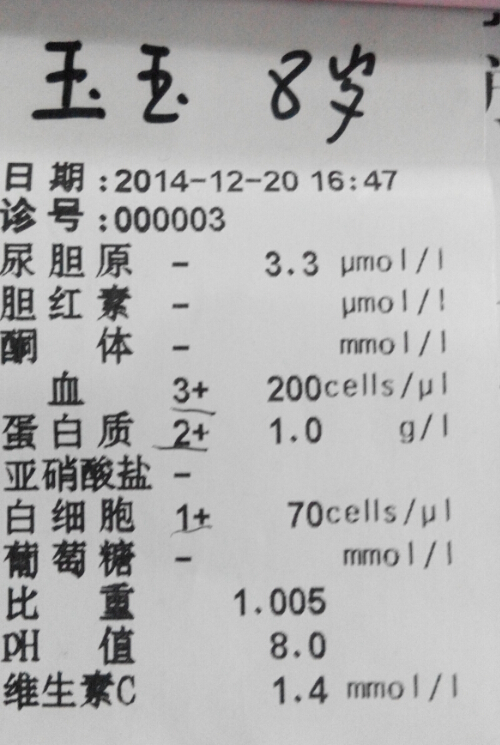 尿常规检查