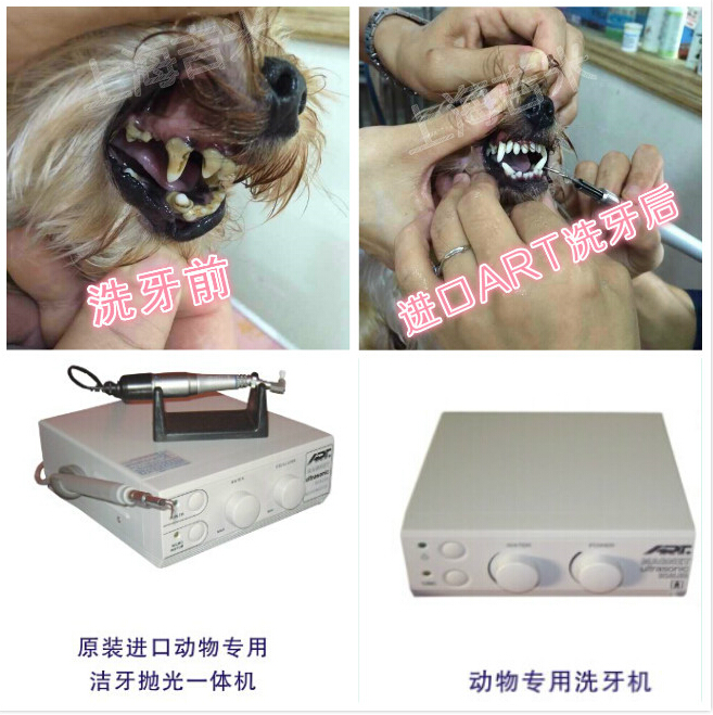 洗牙，洁牙